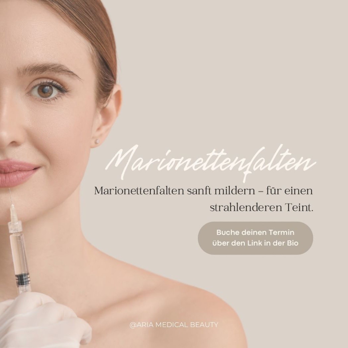 Marionettenfalten behandeln mit Hyaluron, Aria Medical Beauty